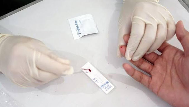 523 Santri Ponpes Yayasan Insan Pratama Rapid Test, Gegara Hanya Satu Santri Perempuan Positif Covid-19